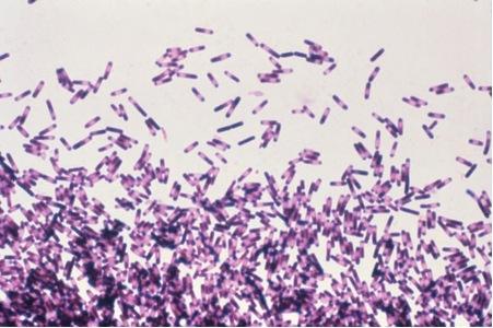 研究人员发现可以预防艰难梭菌引起的腹泻的抗生素