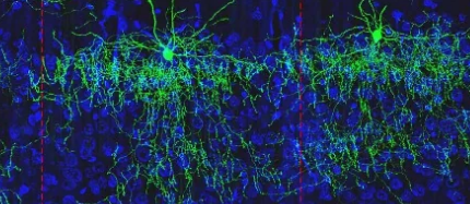脑科学家在映射小鼠皮层方面取得了长足进步