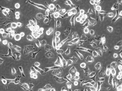 是什么使肝巨噬细胞成为肝巨噬细胞