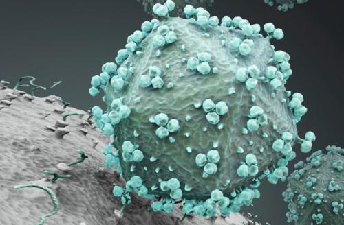 艾滋病毒尽管有药物治疗但免疫系统中的孔仍未修复