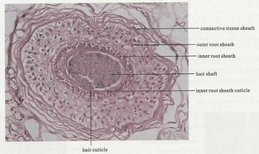 新技术可能揭示人类毛囊的健康