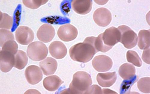 为什么疟原虫比人的免疫细胞更快