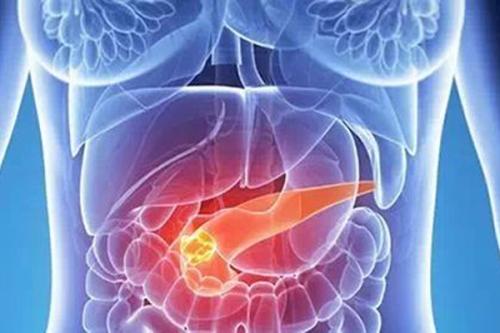 新指南阐明了放射治疗在胰腺癌治疗中的作用