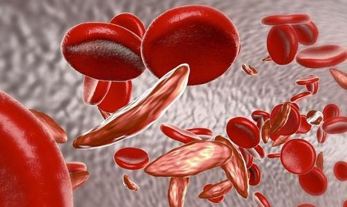 研究发现血液疾病的新型治疗方法