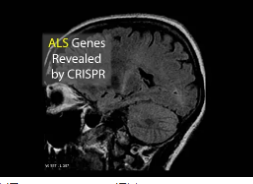 CRISPR在短短两周内扫描整个人类基因组的ALS突变
