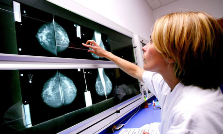 75岁以上的健康女性可能无法继续进行乳腺癌筛查