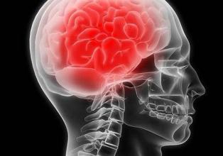 唾液中的分子可以帮助诊断脑震荡