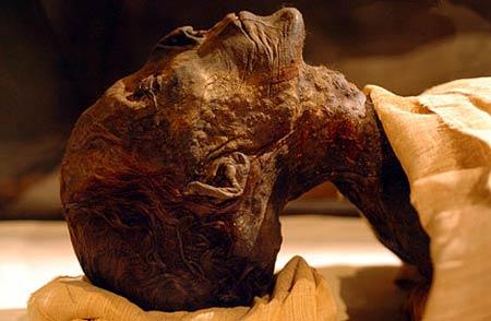 科学家用X射线和红外光探索埃及木乃伊的骨头