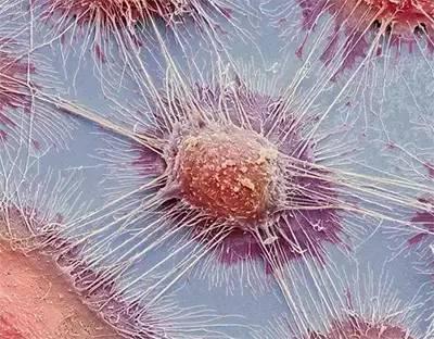 细胞死亡或癌症生长时凝聚力的问题