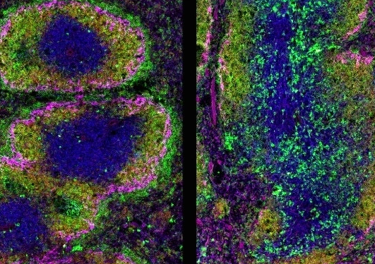 科学家展示蛋白质Ikaros如何协调精细平衡以控制自身免疫