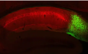 麻省理工学院发现记忆的大脑回路