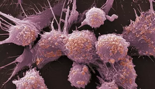 研究人员发现癌细胞如何超越环境线索以消耗能量