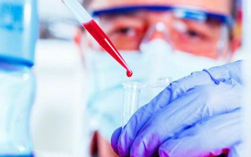 开发新的结核病血液检测方法