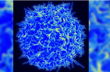 T细胞可能在帕金森氏病中起重要作用