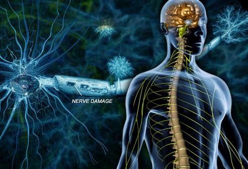 研究人员只用microRNA来治疗多发性硬化症