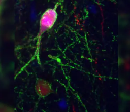 研究人员发现了一种分子机制可通过经验改变神经元的联系