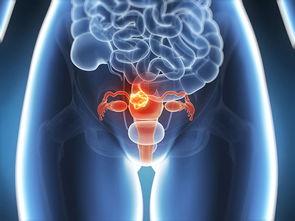 无标记激光显微镜技术准确检测卵巢转移癌