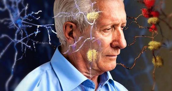 超过60000个人的研究强调了阿尔茨海默氏病的早期检测需求