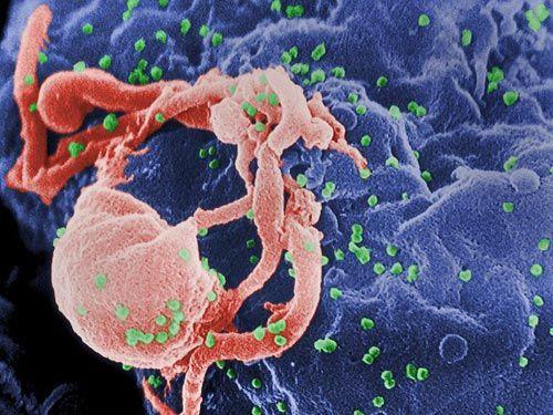 科学家呼吁控制和治疗巴基斯坦史无前例的儿童艾滋病毒爆发