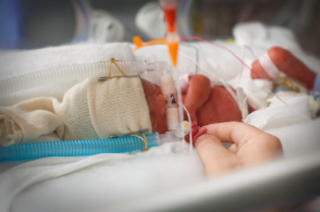 如何保护早产儿免受普通脑部疾病的新见解
