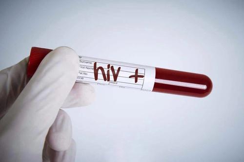 婴儿开始HIV治疗的时机是否重要