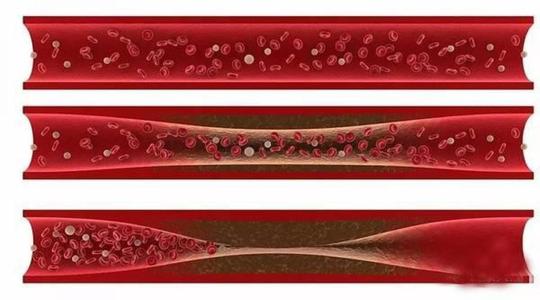 改良的三同轴3D细胞打印技术允许制造多层血管