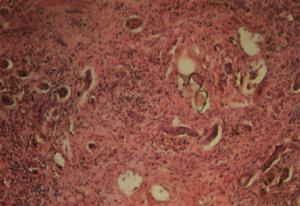科学家们已经分离出一种天然化学物质 可以有效地抵抗rypto虫