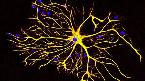 大脑外部的光可以打开猴脑中的神经细胞