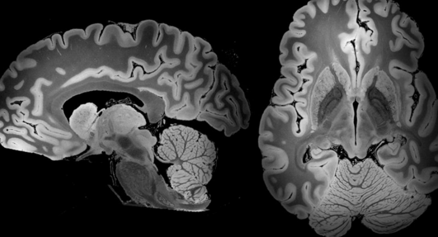 100小时的MRI扫描捕获了整个人脑的最详细外观
