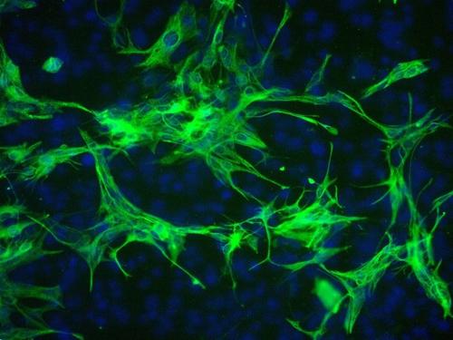星形胶质细胞保护神经元免受毒性堆积