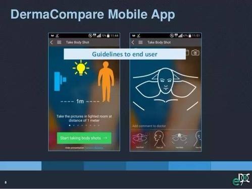 研究表明皮肤癌诊断应用程序不可靠且监管不力
