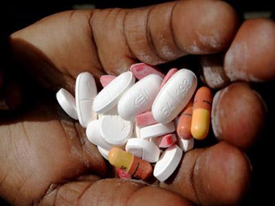 预测HIV感染者对检查点抑制剂免疫疗法的反应