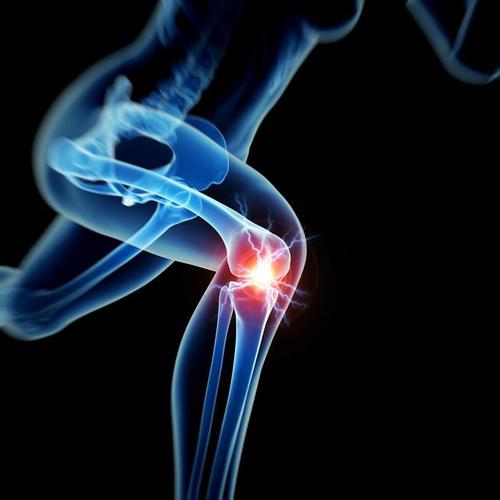 对大多数患者而言膝盖置换的时机都是错误的