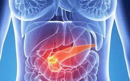 胰腺癌肿瘤分类可以优化治疗选择