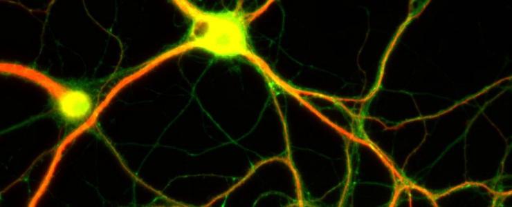 研究人员通过破译大脑皮层神经元的遗传程序 揭示了控制我们大脑细胞发生的机制