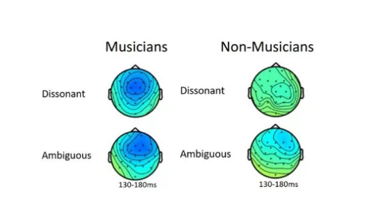 音乐家的大脑对不和谐声音的反应不同