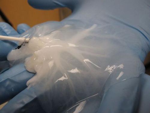 研究人员开发了通过血管3D打印活体皮肤的新方法