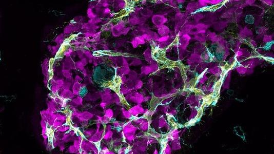 纳米装置解开小鼠癌细胞并向免疫系统揭示它们