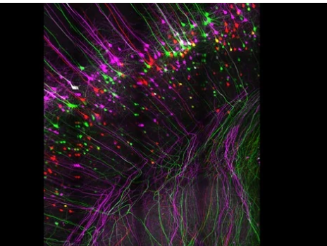 研究人员发现蛋白质阻碍神经生长