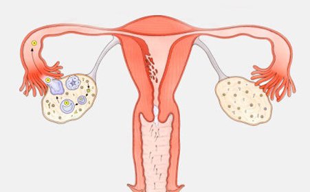 研究人员分析了人类卵巢中的所有细胞类型