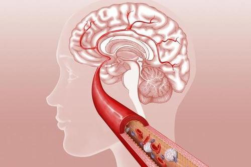 USC的研究为大脑血管系统的崩溃如何提前导致大脑中有毒斑块提供了新的思路