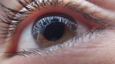 青光眼的免疫系统可能出故障