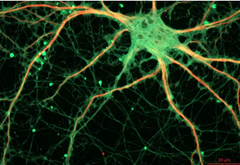 研究人员意外发现神经元如何相互交谈