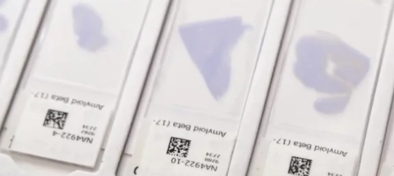 AI工具识别脑组织样本中的淀粉样蛋白斑块