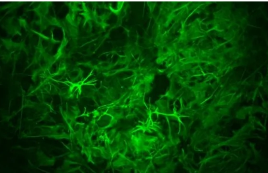 星形胶质细胞在小鼠长期记忆形成中起着惊人的作用