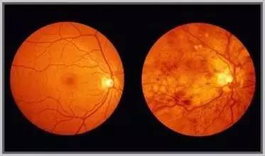 视网膜皮层映射显示是皮层组织地形的主要决定因素