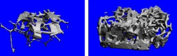 受体删除后观察到的骨量增加高达800％
