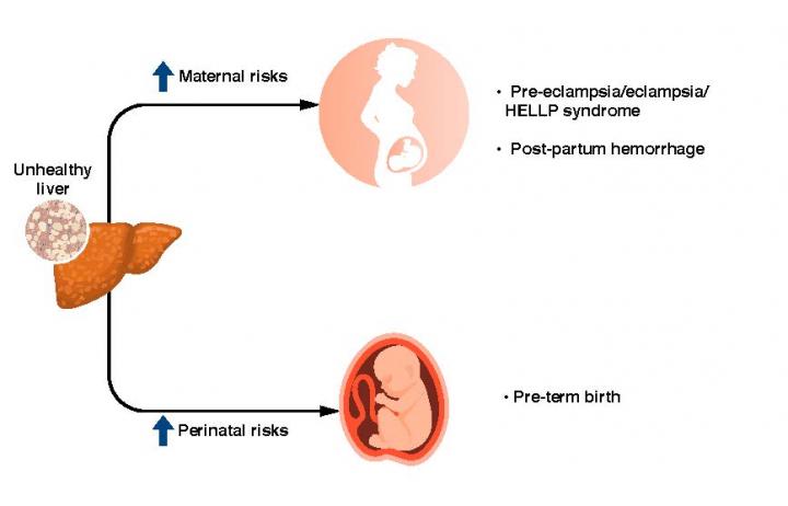 怀孕后的NAFLD会增加母亲和婴儿的风险