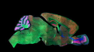 深度分析将鼠标皮质分为133种细胞类型