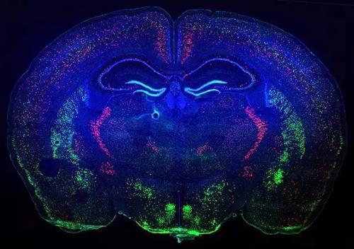 中性粒细胞减少阿尔茨海默病小鼠模型中的脑血流量